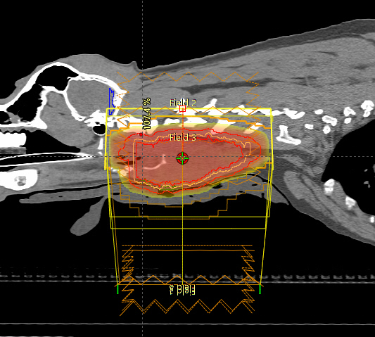 radiation plan